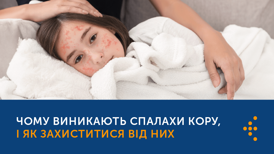 ЧОМУ ВИНИКАЮТЬ СПАЛАХИ КОРУ, І ЯК ЗАХИСТИТИСЯ ВІД НИХ